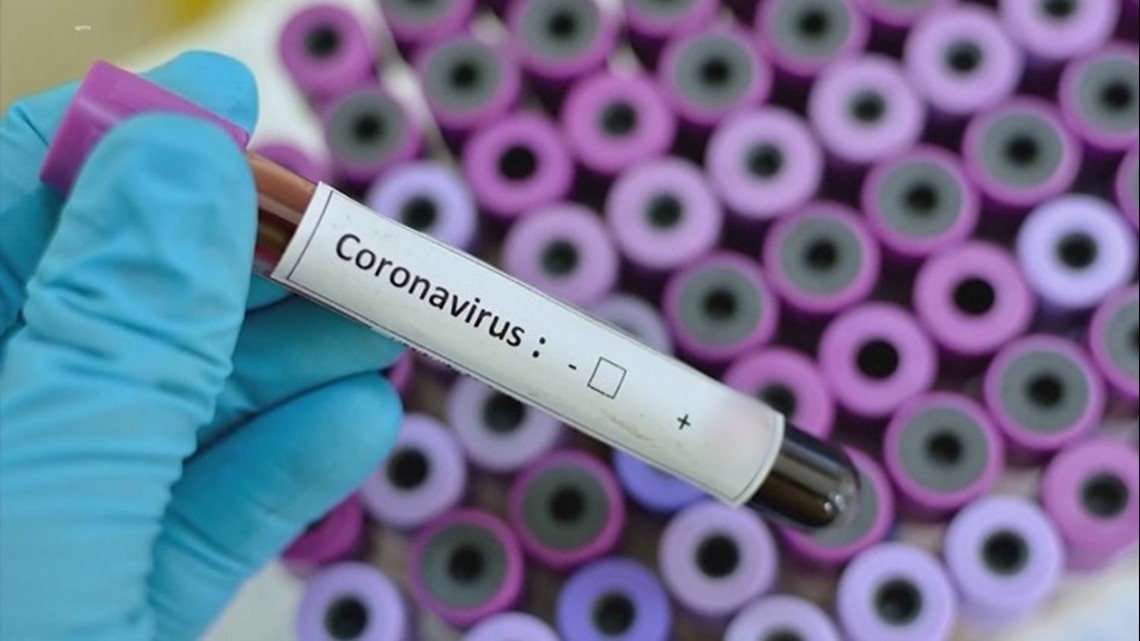 30-minute COVID-19 at-home test kit allowed by FDA | 0
