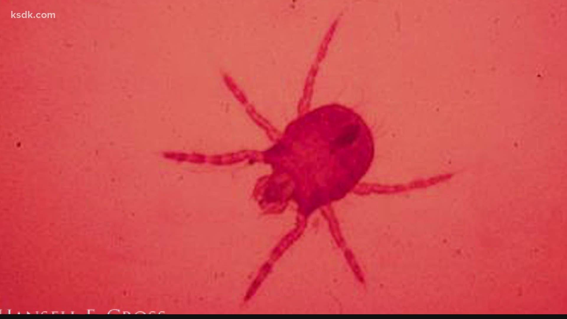 Chigger bites can be quite annoying, and they are particularly common around this time of years