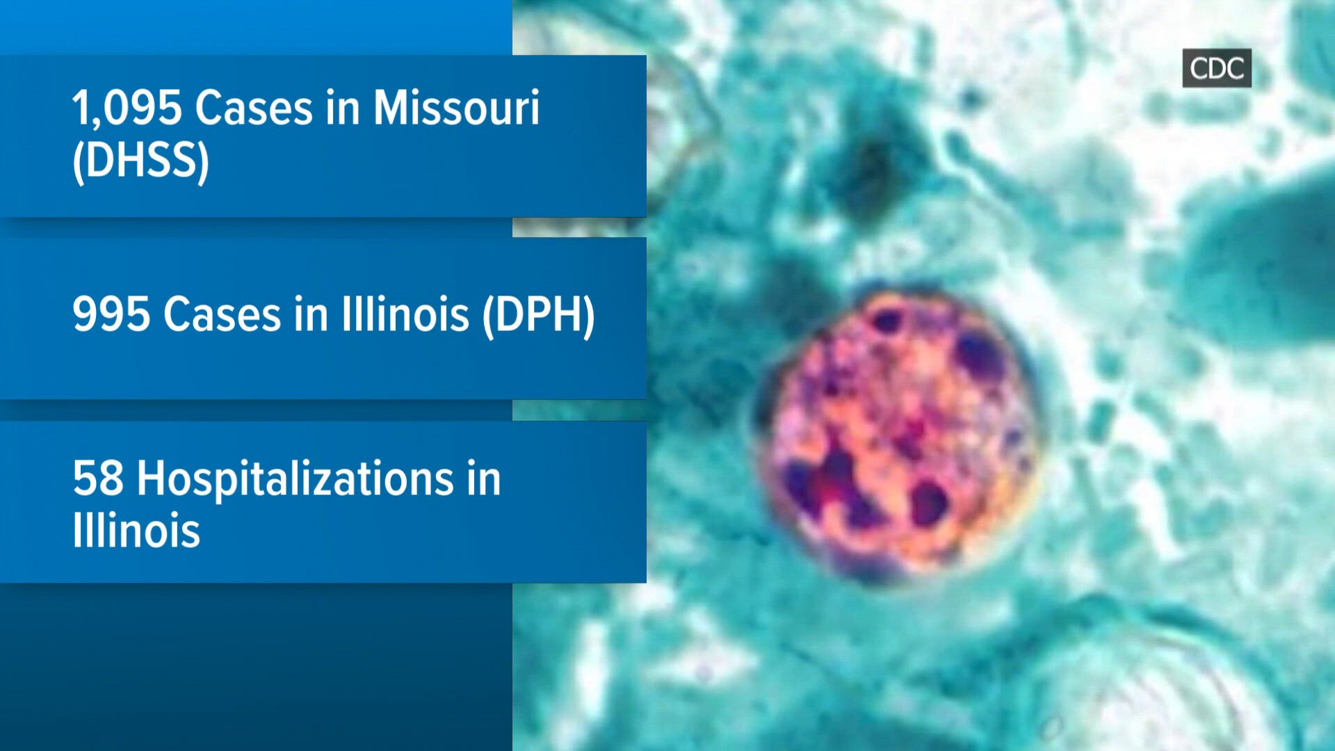 Doctors say cyclospora cases nearing peak, urge hydration and caution with lettuce