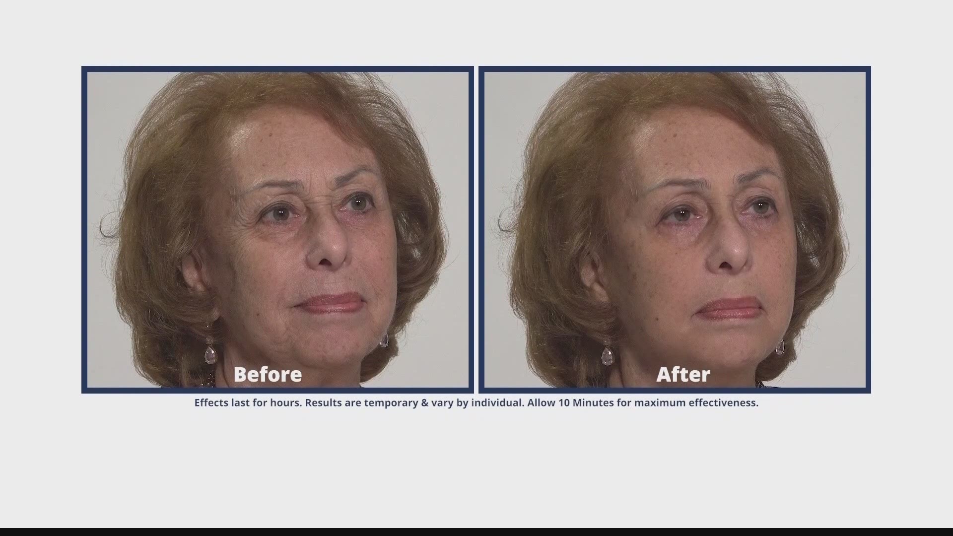 A lot of our viewers have taken the Plexaderm 10-minute challenge to shrink their under-eye bags and wrinkles from view.