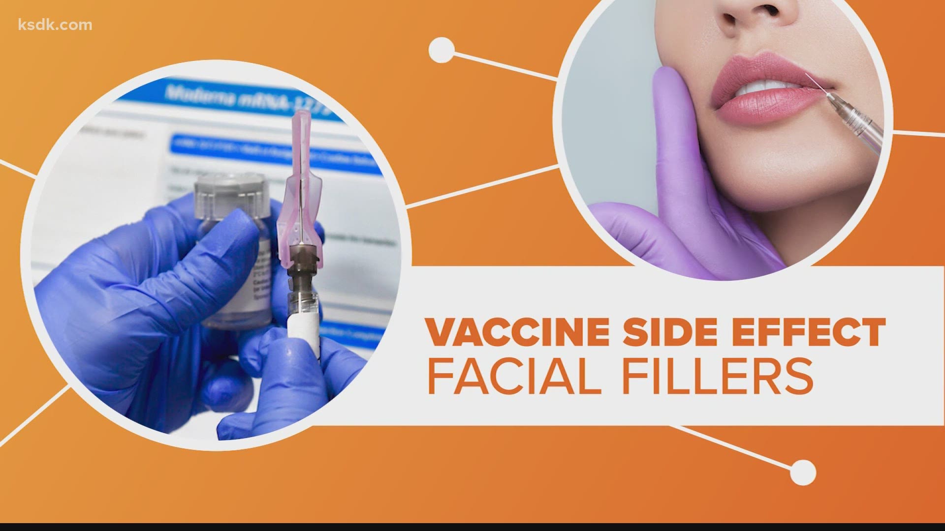 The FDA has a warning about an unusual side effect for the Moderna coronavirus vaccine for patients with cosmetic facial fillers