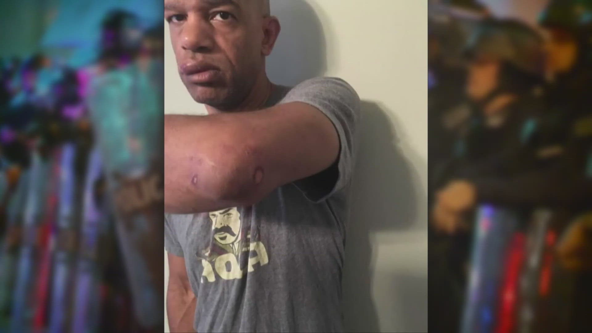 St. Louis police have reopened an internal investigation into the assault of former Detective Luther Hall. He was beaten by white officers while working undercover.