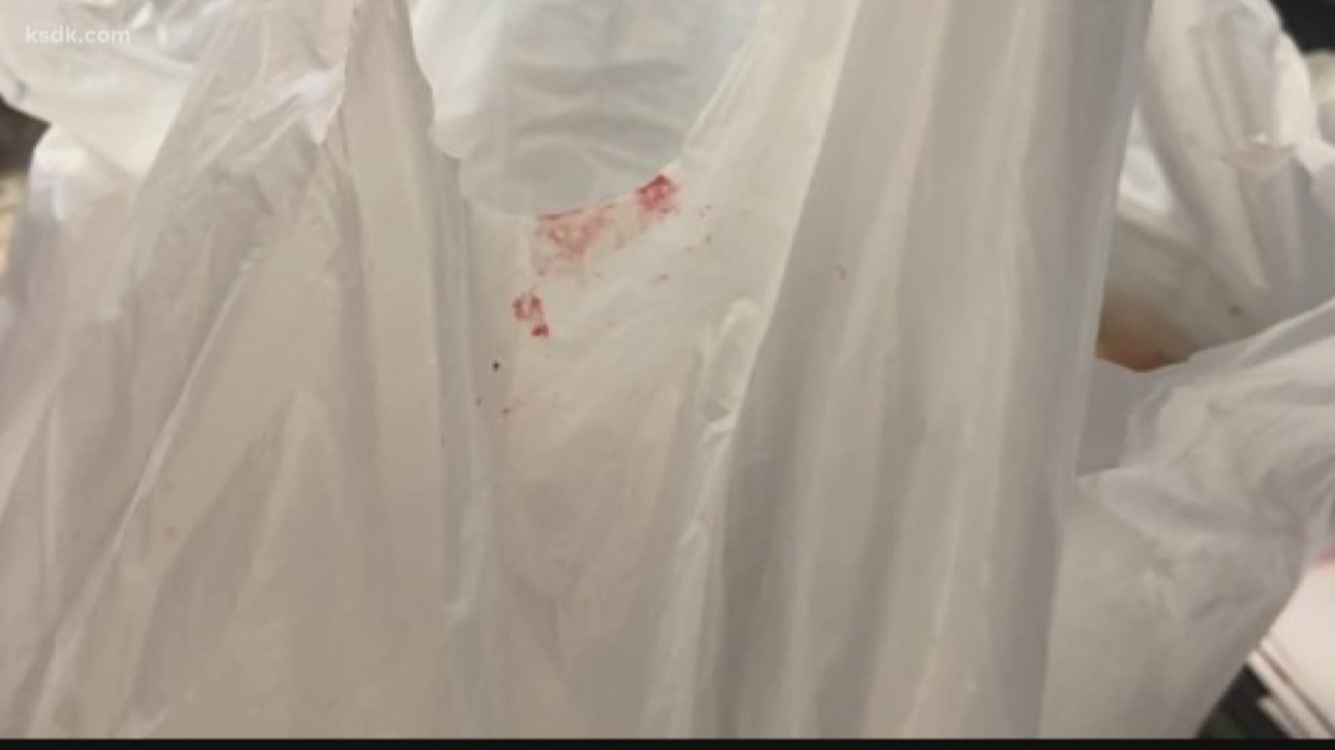 You finish grocery shopping to find bloody fingerprints all over your shopping bags. That's what happened to one local family on a trip to the Twin Oaks Schnucks.