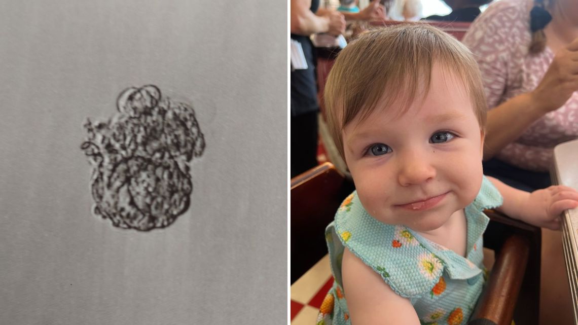 She was a frozen embryo for 10 years; now she is a baby with a St. Louis family