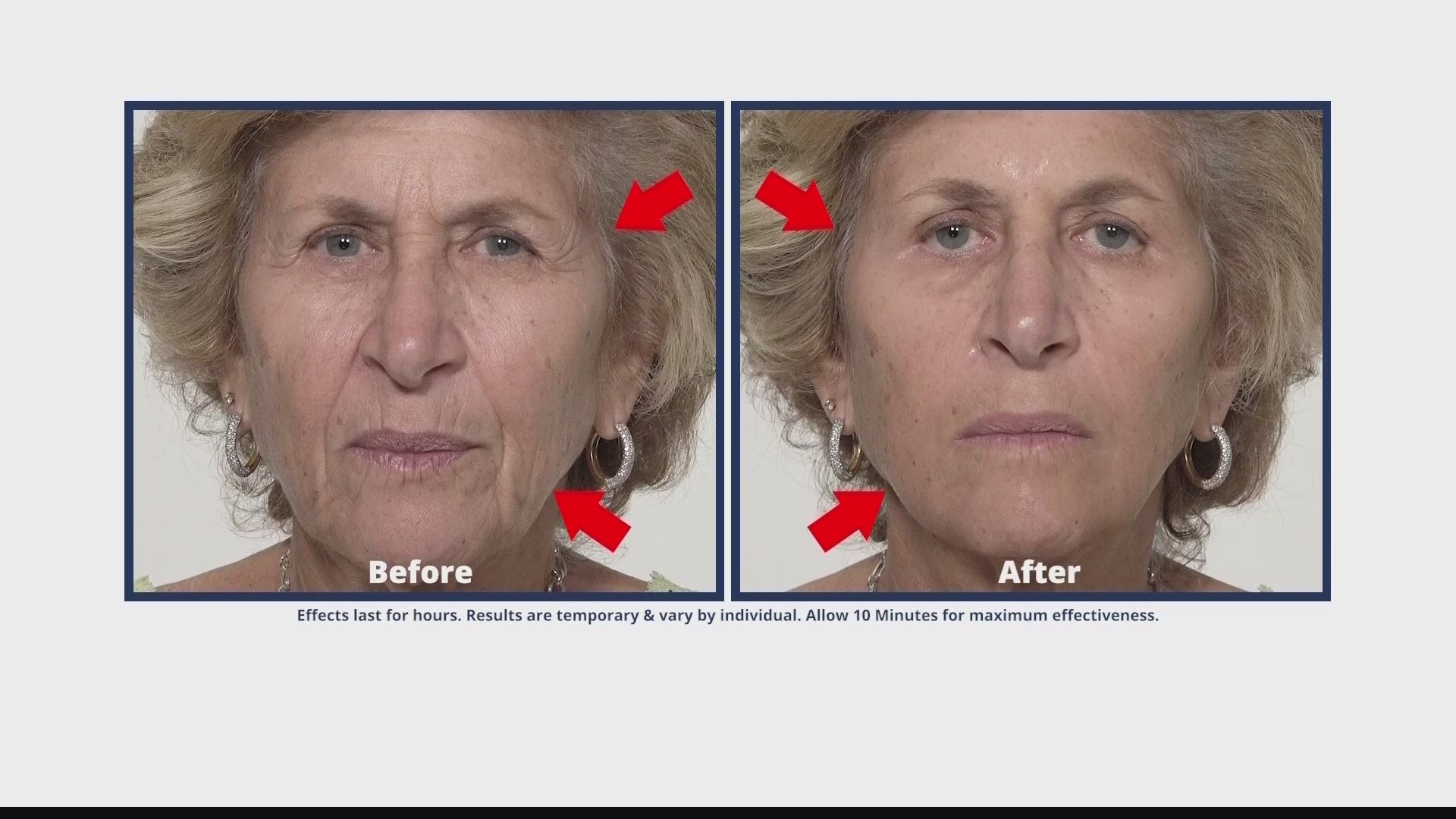 Take years off of your appearance in just minutes with Plexaderm.