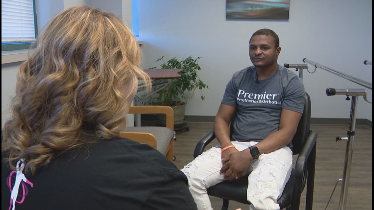 Man who lost leg in shooting now makes a difference for other amputees at Kirkwood prosthetics service