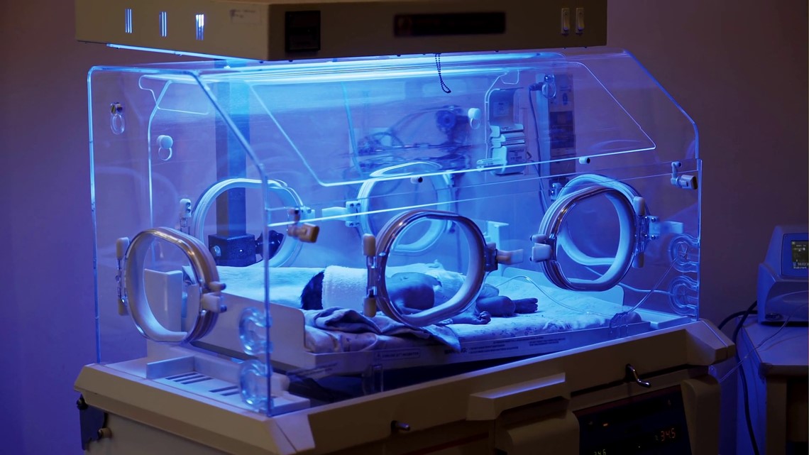 Racial disparities in deadly disease among formula-fed preemies - Vimarsana News