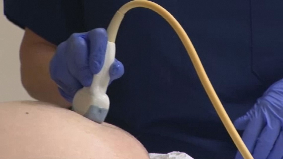 Illinois lawmakers repeal parental notification abortions law - Vimarsana News
