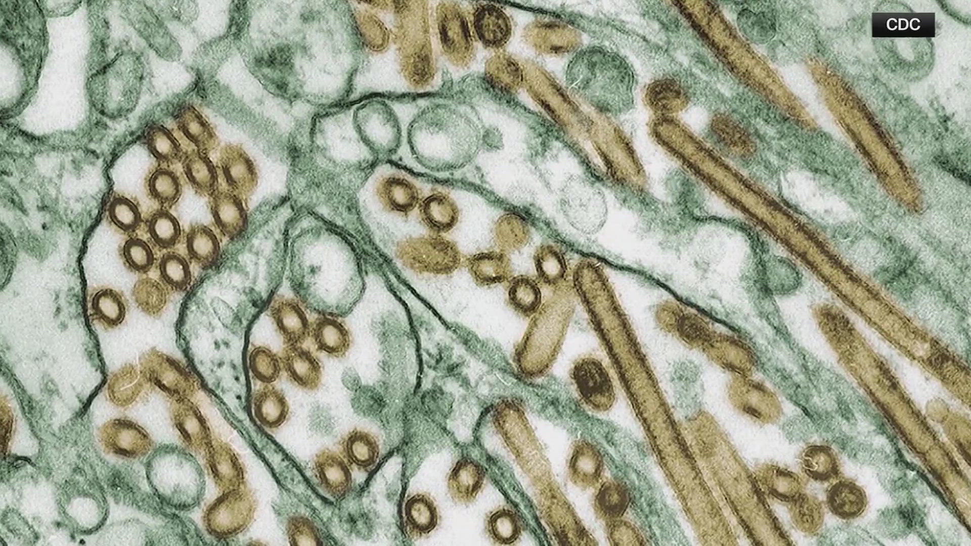 Health officials said Thursday that there's no evidence bird flu is spreading between people after investigating a mysterious infection in Missouri.