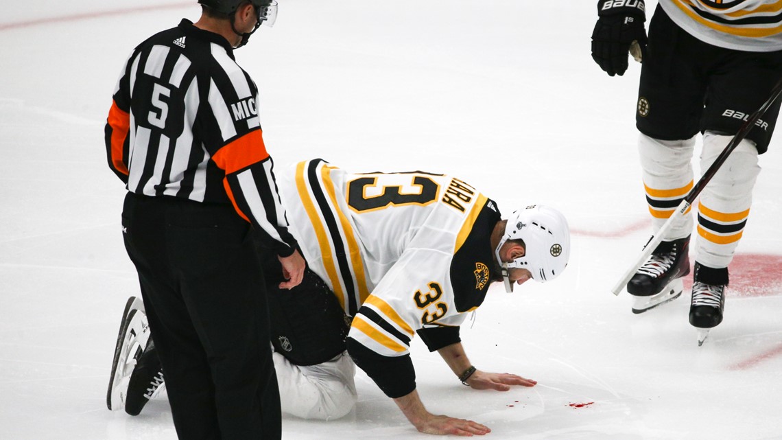 NHL: Bruins' Zdeno Chara played with plates, wires, screws to fix broken jaw