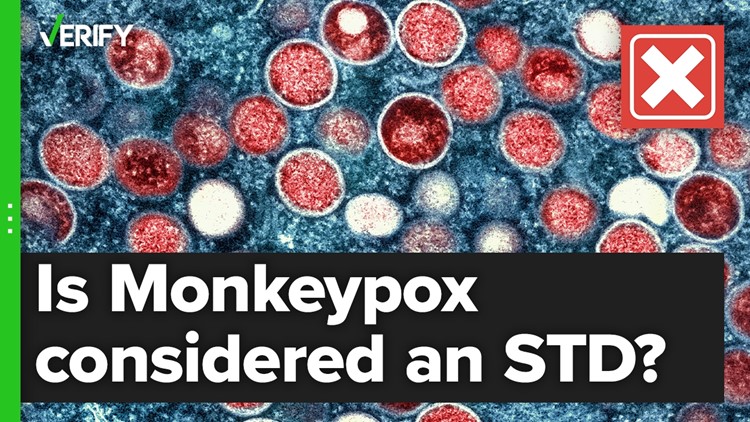 Monkeypox is not a sexually transmitted disease