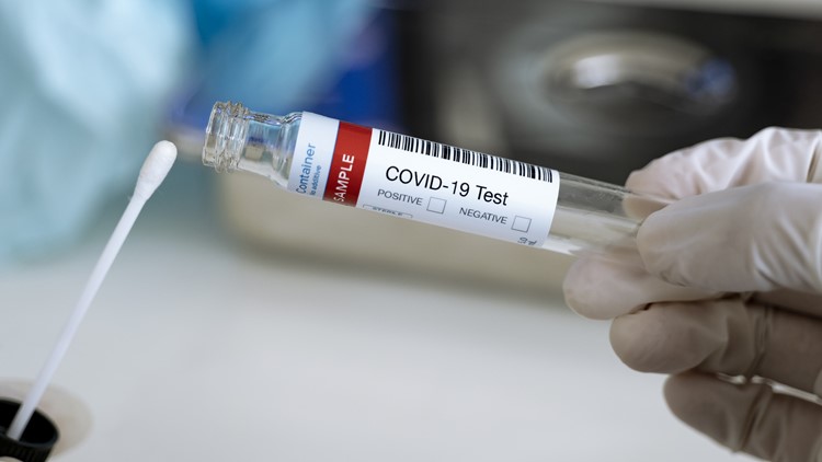 List: COVID testing sites in the St. Louis area and how to get free at-home tests